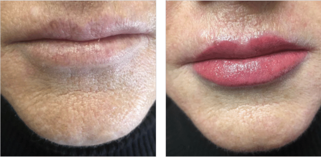Lip Blush Before and After