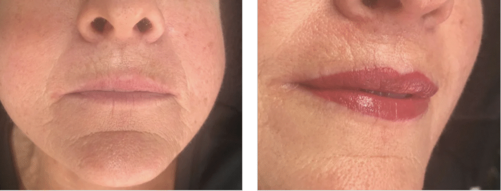 Lip Blush Before and After